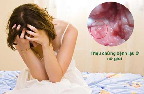 6 dấu hiệu bệnh lậu ở nữ ảnh hưởng trầm trọng đến sức khỏe