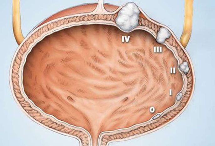 Bàng quang nằm ở đâu? Cấu tạo, chức năng và các bệnh thường gặp