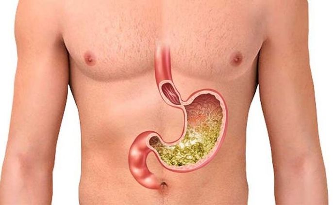 Dạ dày nằm ở đâu? Cấu tạo như thế nào và chức năng ra sao?