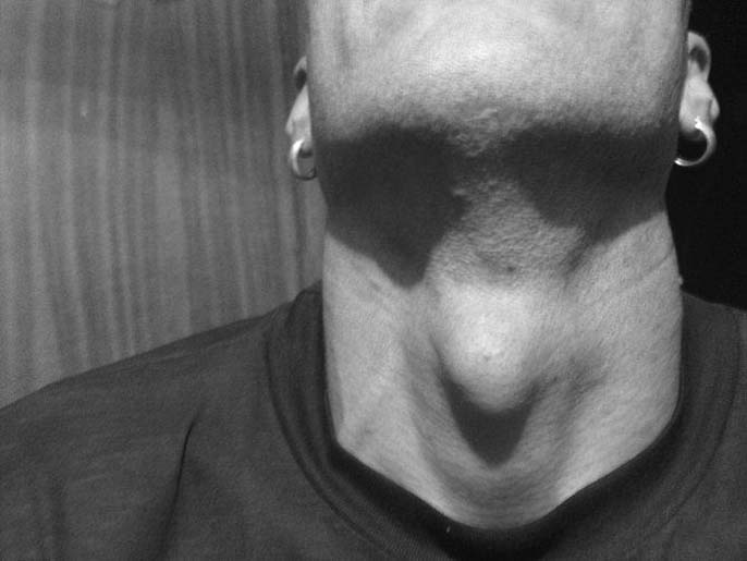 Yết hầu nằm ở đâu? Vì sao chỉ nam giới có yết hầu?